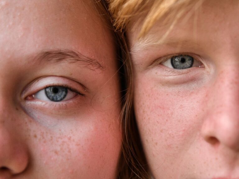 A close-up image capturing the intricate details of two people's eyes and skin texture with visible freckles.